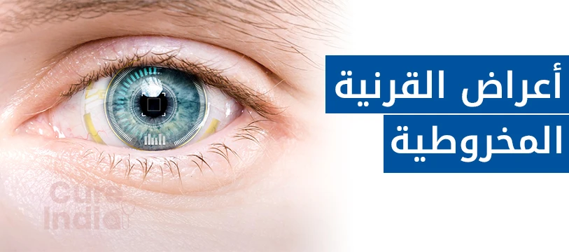 أعراض القرنية المخروطية